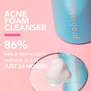 TULA Probiotic Skin Care Keep It Clear Acne Foam Cleanser | Acne Treatment, Clear Up Acne, Prevent Breakouts & Brighten Marks, Contains Salicylic Acid and Probiotics | 6.3 fl. oz TULA Store