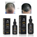 ELEVATE Hair Growth Oil - Biotin Hair Growth Serum & 5% Minoxidil Treatment for Stronger Thicker Longer Hair – Natural Hair Growth Thickening Treatment - Stop Thinning & Hair Loss for Men & Women 1oz Elevate