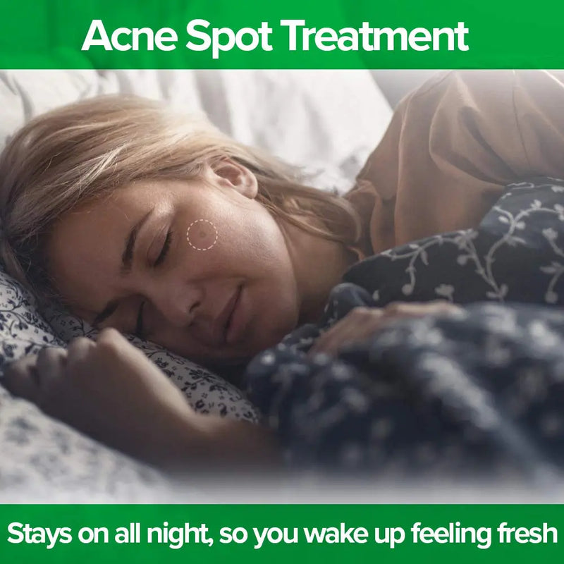 DR. ZAPS Pimple Patches - Acne Patches Work as Pimple Treatment - Hydrocolloid Patches Use Australian Tea Tree Oil. Acne Spot Treatment, Zit Patch, and Acne Patch for Everyone. Keppi