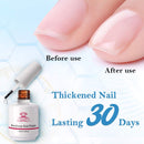 Makartt Gel Nail Strengthener Reinforce Polish, Nail Strengthening Repair Polish Nail Hardener for Treating Weak Damaged Peeling Nails Clear Soak Off Gel Lacquer Long Lasting Professional DIY Nail Art Makartt