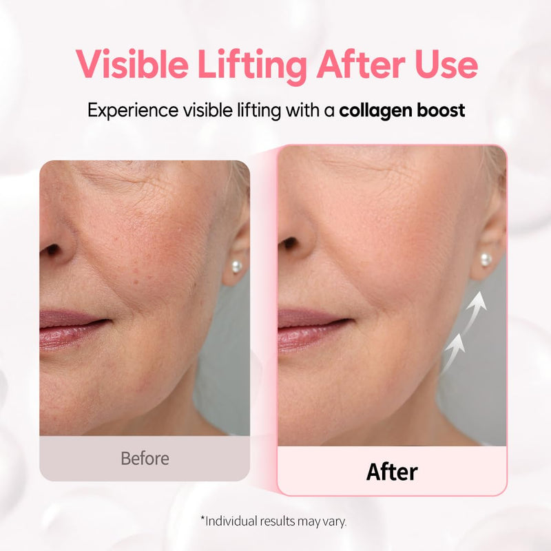 Overnight Collagen Lifting Gel Mask 5 pcs, Korean Face Lifting Deep Hydrogel Mask for Glass Skin, Anti-Aging with PDRN (Salmon DNA), Hyaluronic Acid for Elasticity, Firmness Infinity Warehouse