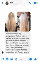 Moerie Ultimate Mineral Hair Growth Spray – For Longer, Thicker, Fuller Hair - with Biotin & Caffeine - Vegan Hair Products – Paraben Free – All Hair Types – Reverse Hair Loss M MOÉRIE