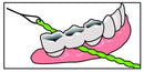 IDontix Brace X-Floss, Green Idontix