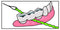 IDontix Brace X-Floss, Green Idontix