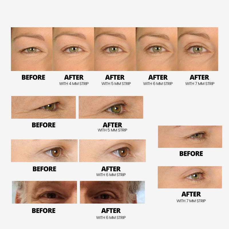 LIDS BY DESIGN (4mm) Eyelid Correcting Strips for Slight Lift, 80 count Contours RX