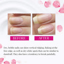Nail Tek Foundation 3, Ridge Filling Strengthening Base Coat for Hard and Brittle Nails, 0.5 oz, 1-Pack Nail Tek