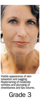 Fillerina Eye and Lip Contour Cream-Anti Aging Cream With Hyaluronic Acid (Grade 3) Fillerina