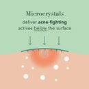 Rael Miracle Microcrystal Spot Cover - Hydrocolloid, Acne Pimple Spot Patches with Tea Tree Oil, Early Stage (18 Count) Rael
