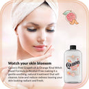 Quinn’s Alcohol Free Witch Hazel with Aloe Vera 16 Ounce (Pink Grapefruit and Orange Rind) Quinn's