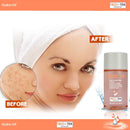 Hydra-Oil Scar Removal Serum - Scar Treatment for Face and Body - 50 ml Hydrating Oil for Acne Scar Remover, Stretch Mark Removal, and to Lighten Dark Spots - Vitamin E & A Hydra Oil
