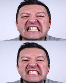 Amazing Temporary Tooth Kit 2 Pack Replacement Temp Dental 25% More Than Others Amazing Temporary Tooth