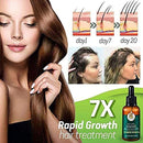 7X Rapid Growth Hair Treatment 7 Day Hair Growth Serum Essence Oil Regrow, with Natural Vitamin Rich Treatm, for Fuller Healthier Hair, Prevent Hair Loss & Thinn(2Pack) FEINASU