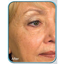 STEM CELL THERAPY CREAM BY BIOLOGIC 1oz JAR Biologic Solutions
