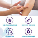 Bruise Busting Treatment Cream, For Those Who Bruise Easily, With Arnica Butter, Lavender and Turmeric, All Natural, 4 oz, By Diva Stuff Diva Stuff