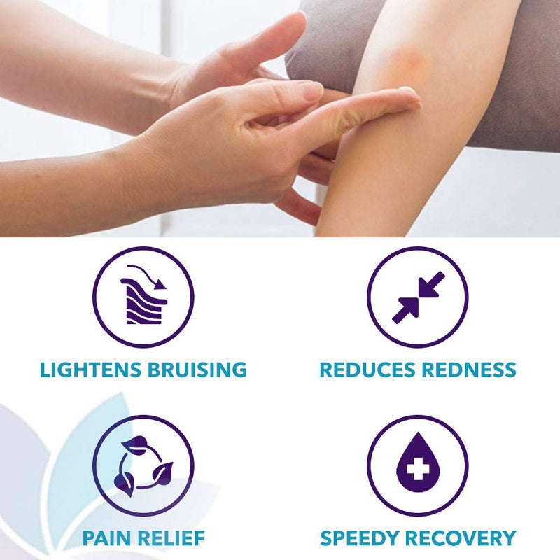 Bruise Busting Treatment Cream, For Those Who Bruise Easily, With Arnica Butter, Lavender and Turmeric, All Natural, 4 oz, By Diva Stuff Diva Stuff
