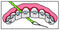 IDontix Brace X-Floss, Green Idontix