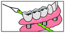 IDontix Brace X-Floss, Green Idontix