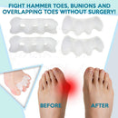 Anatomical Gel Toe Separators, Spreaders & Straighteners- Relieves Foot Pain and Corrects Toes- Pedicure Toe Separator- Used as Toe Guards, Toe Spacer for Hammer and Overlapping Toes- Bunion Corrector Relax Tony