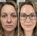 Micro Infusion System for Face & Neck-Micro Infusion Kit to Leave Skin Firmer & Smoother-0.25mm Facial Stamp with Collagen & Hyaluronic Acid Serum for At Home Glow and Anti-aging-3 Month Supply Infinity Warehouse