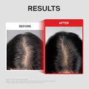 Dr.FORHAIR Folligen Thickening Scalp Serum 1.7 oz | Biotin Density Serum for Thicker, Fuller-Looking Hair | Peptide Scalp Treatment | Korean Haircare Infinity Warehouse
