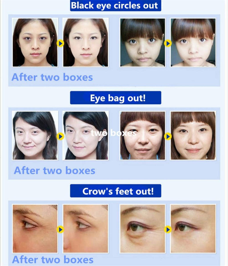 Adofect 30 Pairs Pink Collagen Under Eye Mask Anti-Aging Hyaluronic Acid Eye Patches for Moisturizing & Reducing Dark Circles, Luxury Gift for Women and Men, Pink Adofect