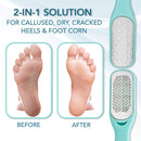 Callus Remover For Feet | Double-sided Foot Scrub -Foot File -Dead Skin Remover -Foot Rasp for Exfoliation -Wet & Dry Feet Scrubber for Smoothing & Softening Feet -Pedicure Tool for Foot Care Relax Tony