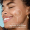 KILLA™ Kit by ZitSticka, translucent pimple patch for deep, early-stage zits, 4 pack ZitSticka