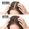 Hair Growth Serum, VOTALA Hair Growth Treatment, Anti Hair Loss, Promotes Thicker, Stronger Hair, And Hair Regrowth for Men Women Votala