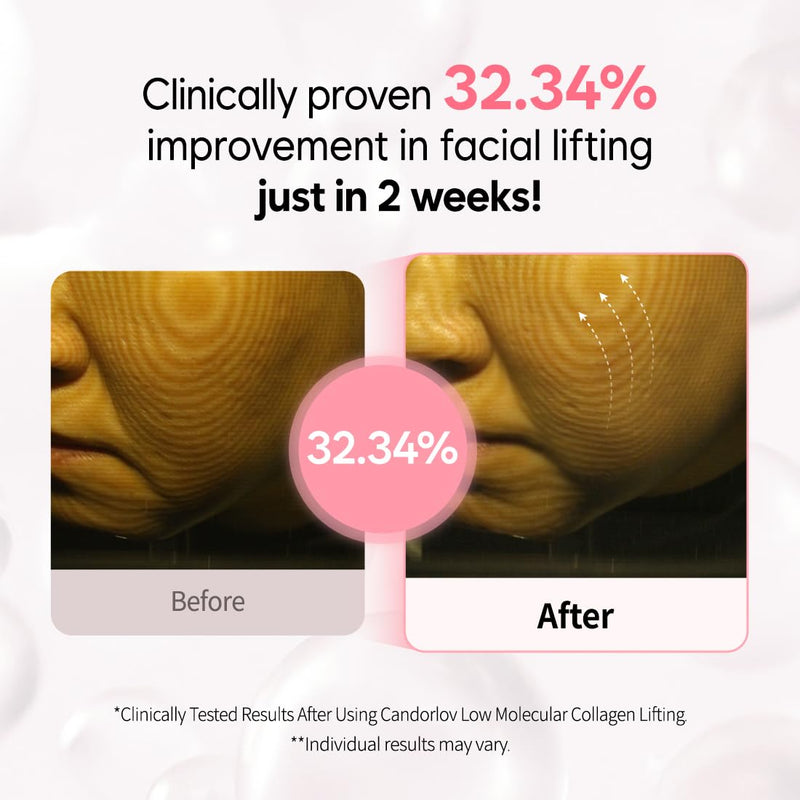 Overnight Collagen Lifting Gel Mask 5 pcs, Korean Face Lifting Deep Hydrogel Mask for Glass Skin, Anti-Aging with PDRN (Salmon DNA), Hyaluronic Acid for Elasticity, Firmness Infinity Warehouse