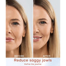 MLAY Professional RF Beauty Machine, Radio Frequency Face Machine with 2 Probes, at Home Radio Frequency Skin Tightening for Lifting, Wrinkle Reducing, Anti Aging - Salon Effects（Gel Included） Infinity Warehouse