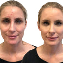 Full Coverage Concealer Palette, Waterproof Concealer Cream, 3 Colors + Brush, by Dermaflage Dermaflage