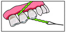IDontix Brace X-Floss, Green Idontix