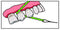 IDontix Brace X-Floss, Green Idontix