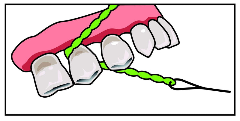 IDontix Brace X-Floss, Green Idontix