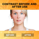 Vitamin C Serum for Face with Hyaluronic Acid to Rejuvenate Face And skin Best Serum for Anti Aging with Natural Ingredients Dark Circles Anti Wrinkl Fine Lines and Sun Damage Corrector PODO