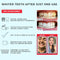 Zimba All-in-One Teeth Whitening Kit - 14 Delicious Mint Treatments (28 Strips), 1 Minty Teeth Whitening Powder, 1 Cool Blue Desensitizing Pen & 1 Bamboo Toothbrush | Non-GMO, Gluten-Free, Soy-Free Zimba