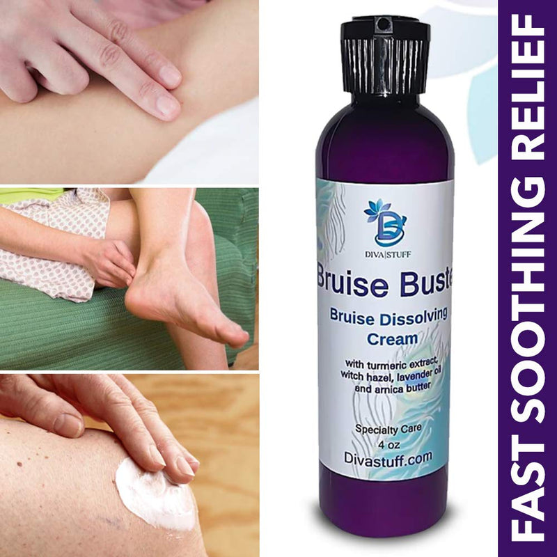 Bruise Busting Treatment Cream, For Those Who Bruise Easily, With Arnica Butter, Lavender and Turmeric, All Natural, 4 oz, By Diva Stuff Diva Stuff