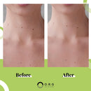 O.R.G Skincare Mineral Peel Body Exfoliator - K-Beauty Body Peel for Smooth, Glowing Skin - Gentle Non-Abrasive Exfoliating Formula for Sensitive Skin, Natural & Cruelty-Free, 6 ounces Infinity Warehouse