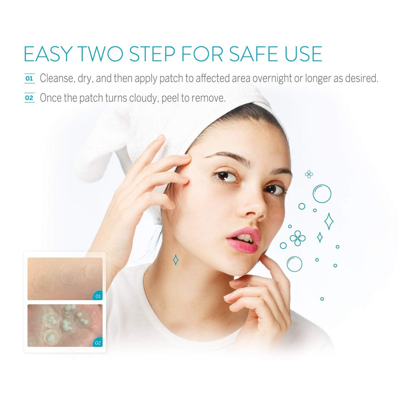 Avarelle Pimple Patches (40 Count) Hydrocolloid Acne Patches, Acne Spot Treatment for Blemishes and Zit with Tea Tree Oil, Calendula Oil and Cica Oil for Face, Vegan, Cruelty Free Certified (40 PATCHES) AVARELLE
