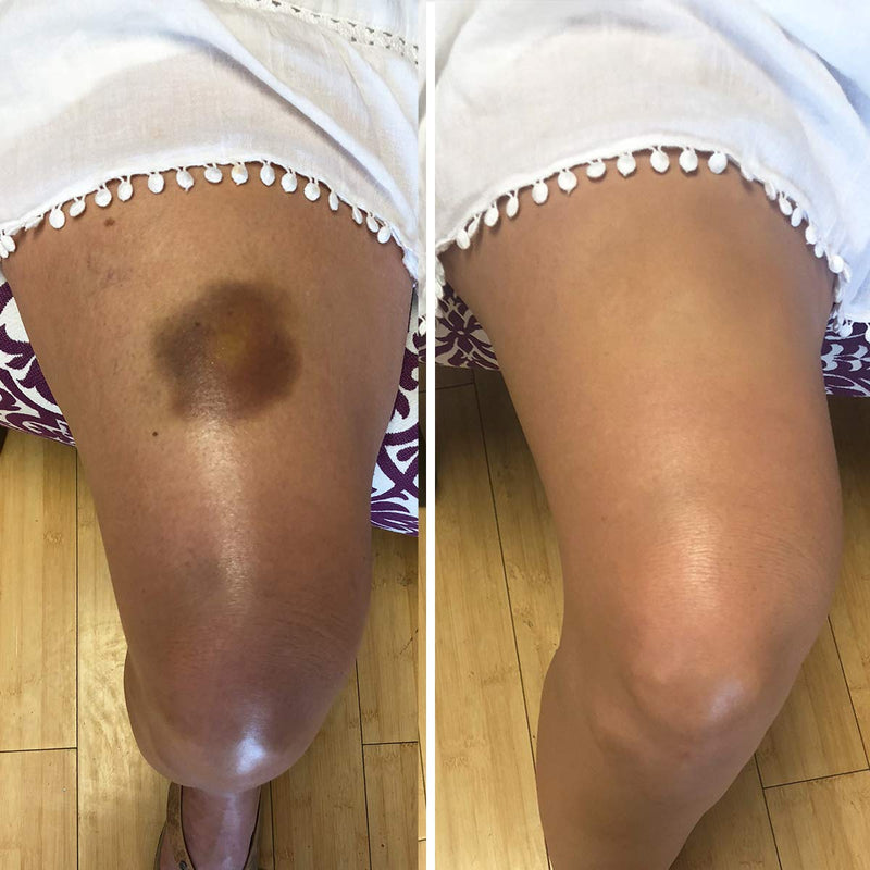 Waterproof Concealer Cream, Full Coverage Waterproof Makeup, Color Match Promise by Dermaflage, 6g/.2oz Dermaflage