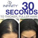 Infinity Hair Fiber - Hair Loss Concealer - Hair Thickening Fiber for Men & Women â White,30g Infinity