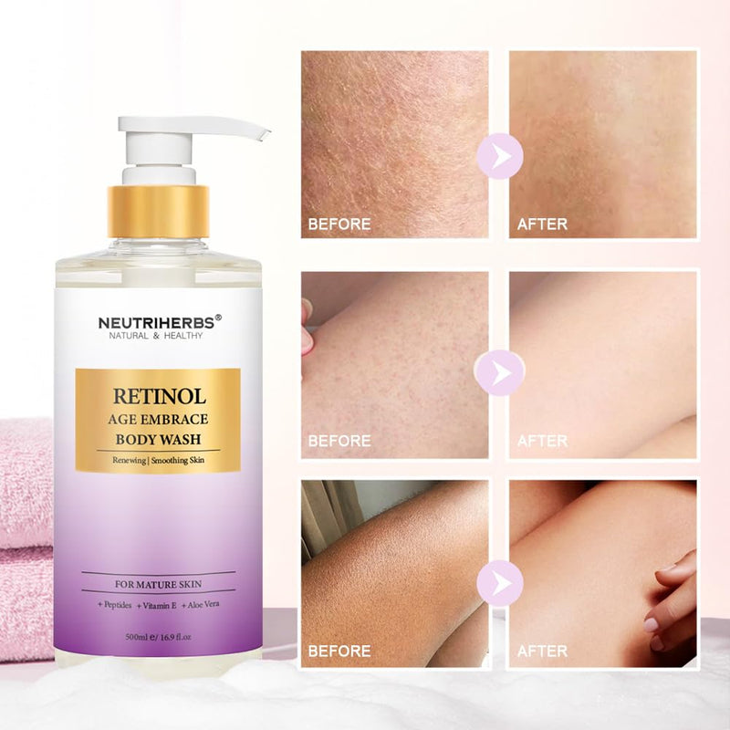 Neutriherbs Retinol Body Wash, Anti Aging/Renewing Shower Gel For Women And Men, Daily Shower Soap With Peptides, Vitamin E, Aloe Vera - Orange Blossom Scent 16.9 Fl.Oz Infinity Warehouse