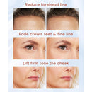 MLAY Professional RF Beauty Machine, Radio Frequency Face Machine with 2 Probes, at Home Radio Frequency Skin Tightening for Lifting, Wrinkle Reducing, Anti Aging - Salon Effects（Gel Included） Infinity Warehouse