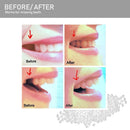 Teeth Repair Kit, Temporary Teeth Replacement Kit, Do it Yourself Thermal Fitting Beads, Moldable False Teeth for Snap On Instant and Confident Smile, F.ZENI F.ZENI