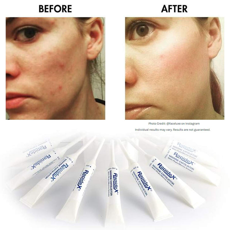 Repechage Rapidex Marine Exfoliator - Natural Facial Exfoliating Scrub with Glycolic & Alpha Hydroxy Acids - Deep Pore Cleansing Gentle Face Exfoliator for Anti-Aging Repechage