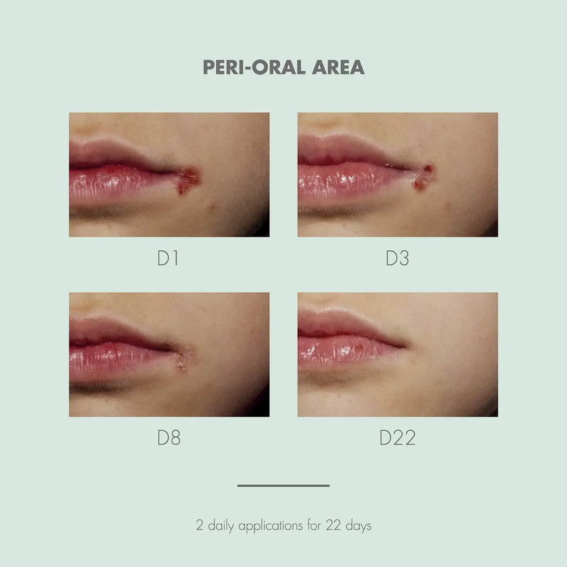 Eau Thermale Avène Cicalfate+ Restorative Protective Cream, Wound Care, Reduce Appearance of Scars Beauty Coquette