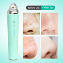 Blackhead Remover Pore Vacuum with Camera, [FDA Certification] Black Head Remover Suctioner 3 Suction Power & 6 Probes, WiFi Real-Time Skin Screen,Upgraded Pimple Vacuum Acne Comedone Extractor CLEASO