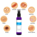 Topical Probiotic Spray For Skin - 13 Strains Live Probiotic Skin Care Dermatic Biome Acne Folliculitis Supplement Dermatitis Rosacea Eczema Treatment Body Face Mist Sprayable Deodorant Microbiome Infinity Warehouse