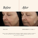 SkinMedica TNS Advanced+ Face Serum - Multi Peptide Serum to Help Improve the Appearance of Wrinkles, Fine Lines, Skin Tone & Texture (1 oz) Infinity Warehouse