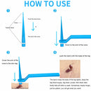 Skin Tag Remover, Safe and Painless Skin Tag Removal Kit for Face, Neck, Finger and Body, Smooth Results Small to Medium (0.08 to 0.2 in) Sized Skin Tags HomeSimlife